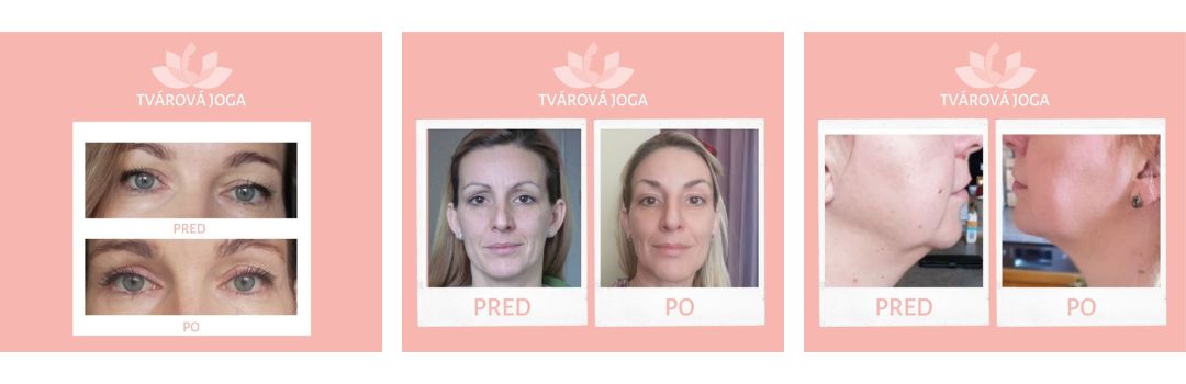 facefit tvarova gymnastika skusenosti 2024